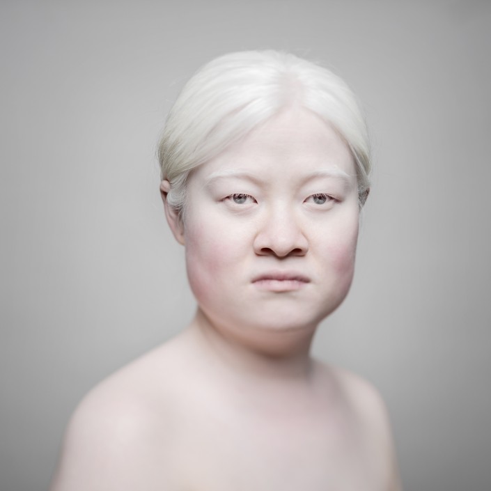 AlbinosAliceLeveque-4-705x705